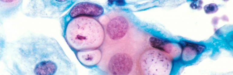 Chlamydia – Clamidea – Chlamidea
