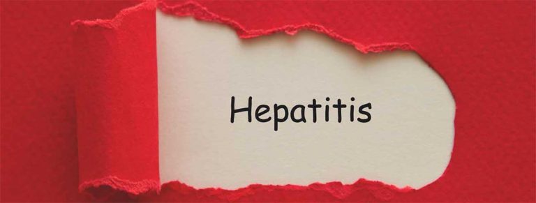 Hepatitis C