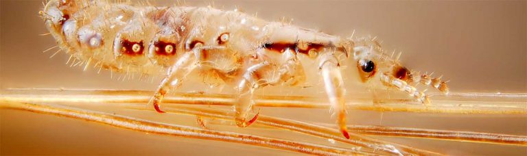 Pediculosis Púbica